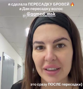Майя Донцова сделала пересадку бровей