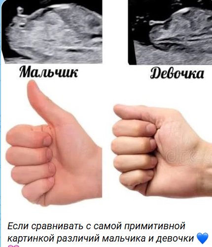 Виктория Салибекова надеется родить дочку, но чувствует, что будет сын