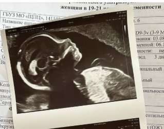 Последние новости дом 2 на сегодня 4 августа 2026