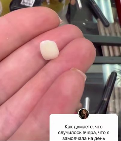 У Нади Ермаковой случилась новая неприятность