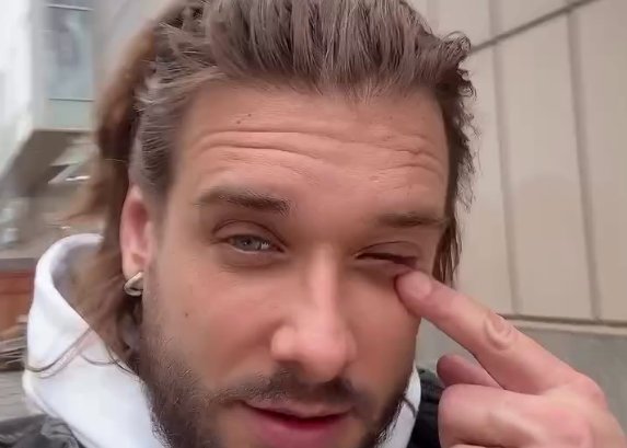 Евгений Ромашов решился на уколы красоты ради улучшения внешности
